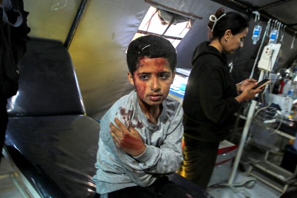 Injured Gaza child needing aid