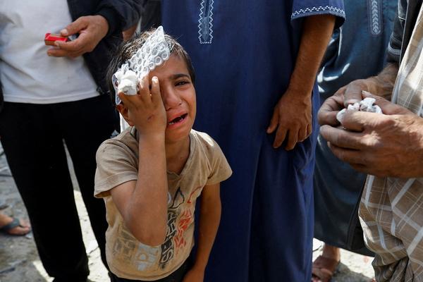 Injured child in Gaza conflict