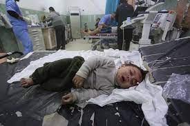 Child victim of Gaza conflict