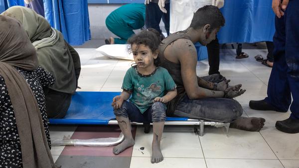 Gaza child affected by war